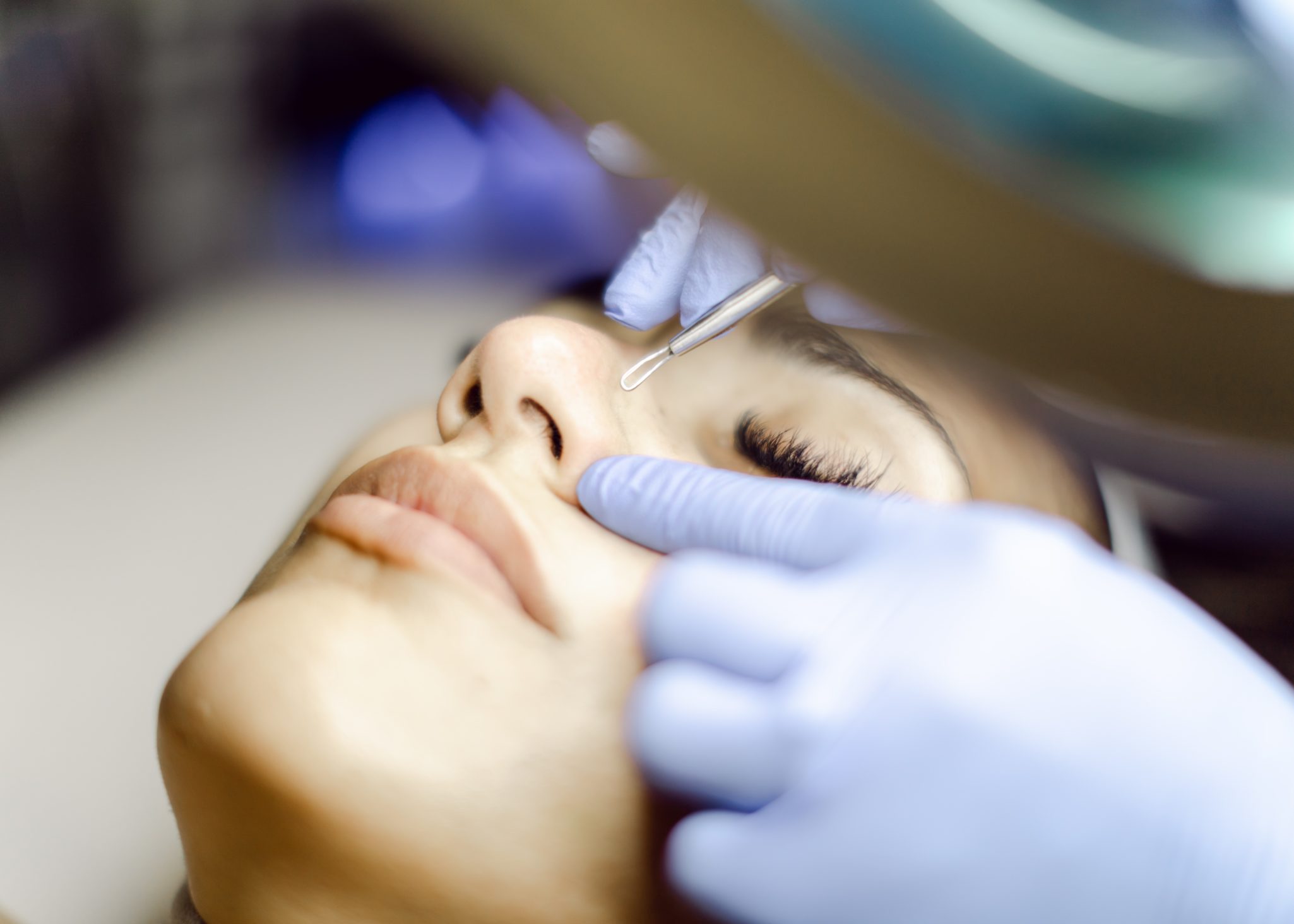 Extractions Extractions